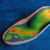 Medilogic Insoles – bezprzewodowa wkładka z mapą nacisku do oceny rozkładu obciążenia stóp.