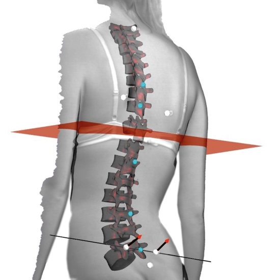 Bodymapper 4D – wizualizacja kręgosłupa i wyników pomiaru postawy w modelu 3D.