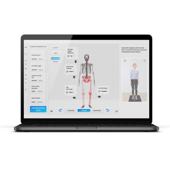 Moti Physio 2 – wizualizacja układu mięśniowo-szkieletowego w badaniu postawy.