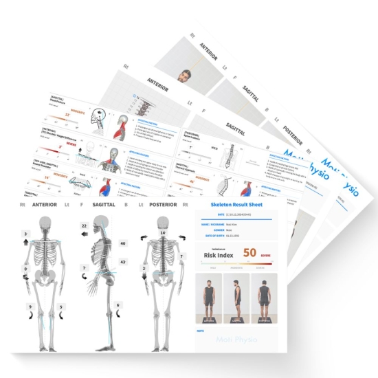 Moti Physio 2 – komputerowa analiza postawy z wizualizacją szkieletu i pomiarami.