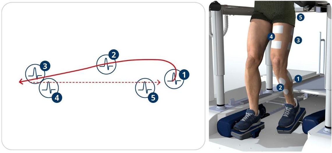 Schemat funkcjonalnej elektrostymulacji mięśni zsynchronizowanej z cyklem chodu w systemie G-EO.