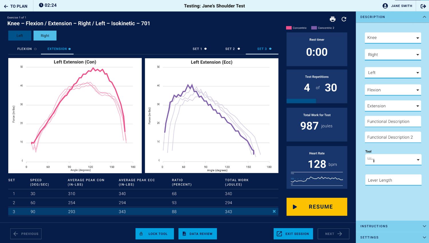 Test izokinetyczny kolana z wykresami siły koncentrycznej i ekscentrycznej.